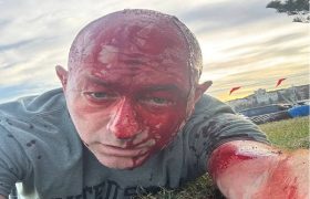 تراژدی سازی در سیدنی برای ترساندن شهرک نشینان/فقط «اسرائیل» امن است همین جا بمانید!